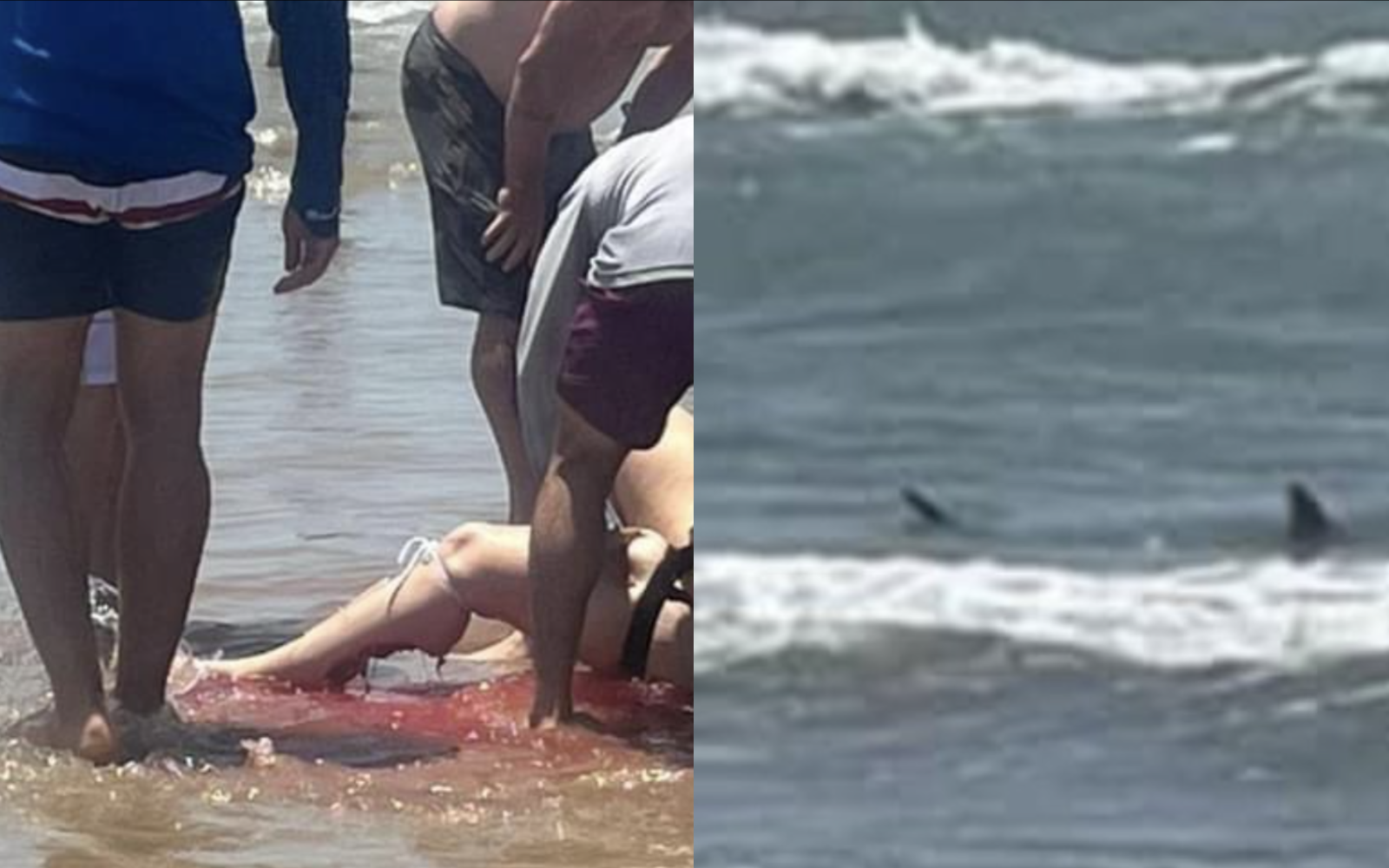 Shark Attack on South Padre Island